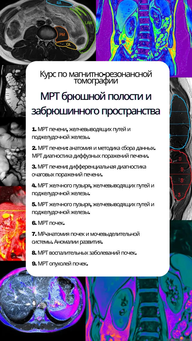 МРТ брюшной полости и забрюшинного пространства — обложка курса