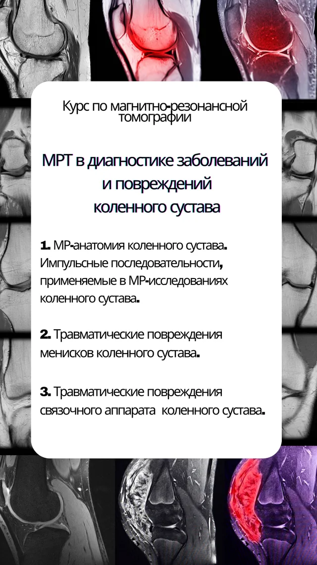 МРТ в диагностике заболеваний и повреждений коленного сустава — обложка курса