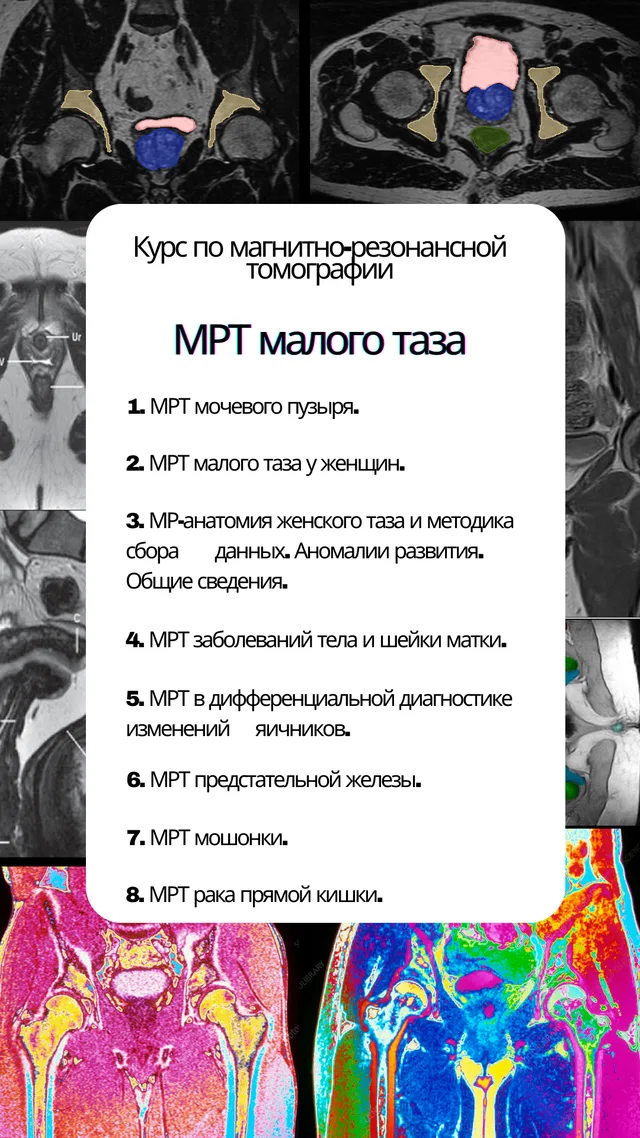 МРТ малого таза — обложка курса