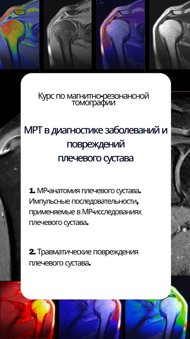 МРТ в диагностике заболеваний и повреждений плечевого сустава — обложка курса