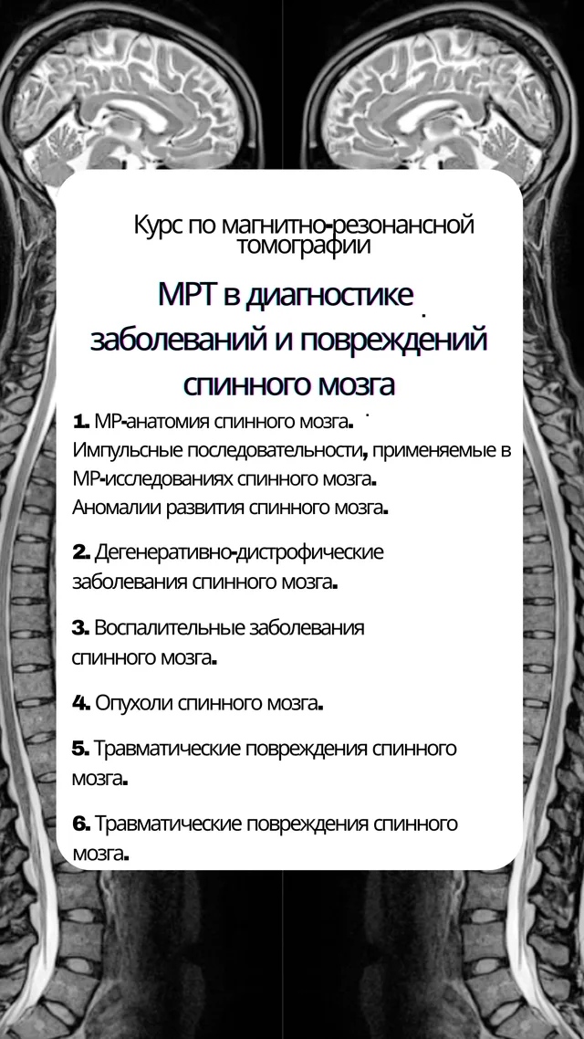МРТ в диагностике заболеваний и повреждений спинного мозга — обложка курса