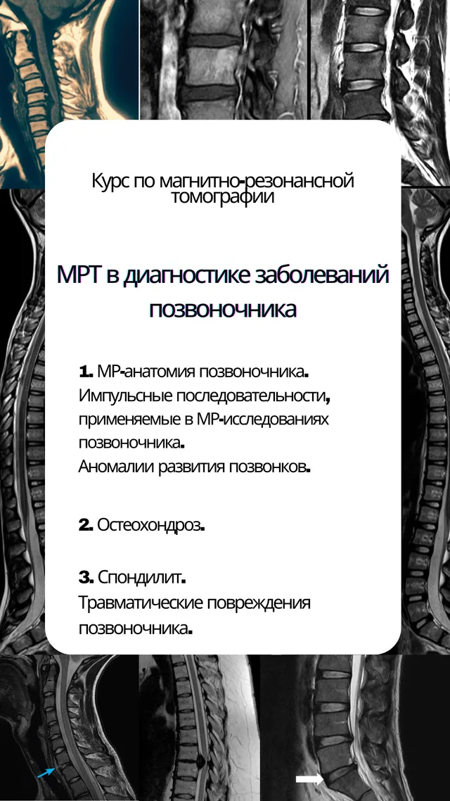 МРТ в диагностике заболеваний позвоночника — обложка курса